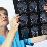 Looking Inside the Vegan Brain by Steve Martindale